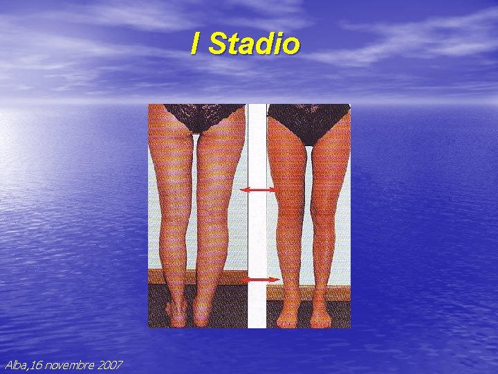 I Stadio Alba, 16 novembre 2007 I Stadio Alba, 16 novembre 2007