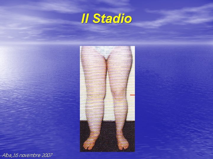 II Stadio Alba, 16 novembre 2007 II Stadio Alba, 16 novembre 2007