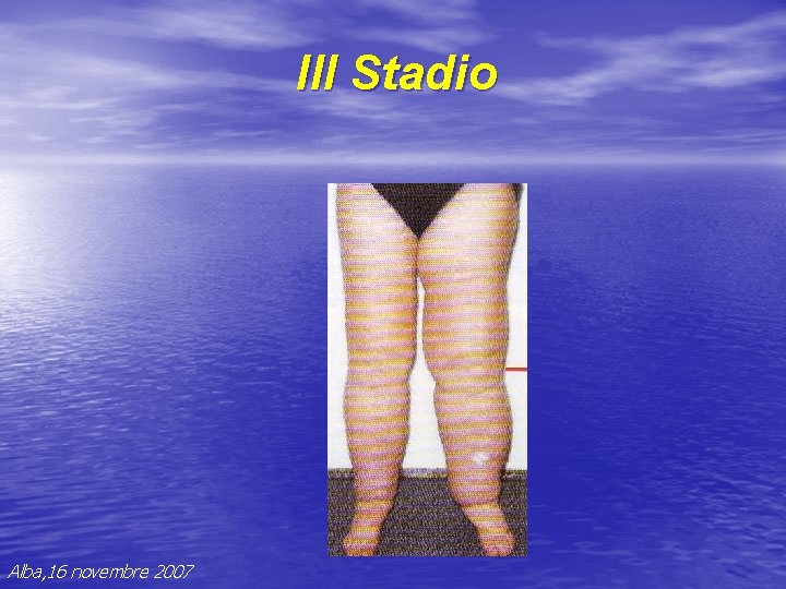 III Stadio Alba, 16 novembre 2007 III Stadio Alba, 16 novembre 2007