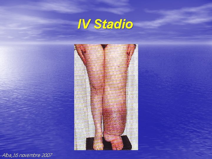 IV Stadio Alba, 16 novembre 2007 IV Stadio Alba, 16 novembre 2007