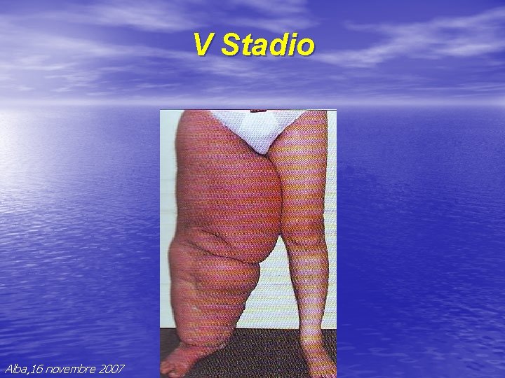 V Stadio Alba, 16 novembre 2007 V Stadio Alba, 16 novembre 2007