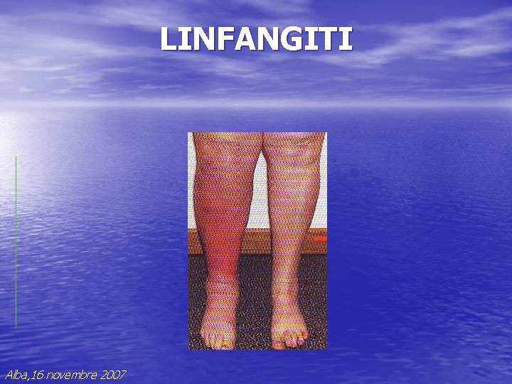 LINFANGITI Alba, 16 novembre 2007 LINFANGITI Alba, 16 novembre 2007
