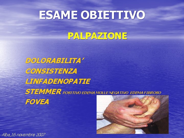 ESAME OBIETTIVO PALPAZIONE DOLORABILITA’ CONSISTENZA LINFADENOPATIE STEMMER POSITIVO EDEMA MOLLE NEGATIVO EDEMA FIBROSO FOVEA ESAME OBIETTIVO PALPAZIONE DOLORABILITA’ CONSISTENZA LINFADENOPATIE STEMMER POSITIVO EDEMA MOLLE NEGATIVO EDEMA FIBROSO FOVEA