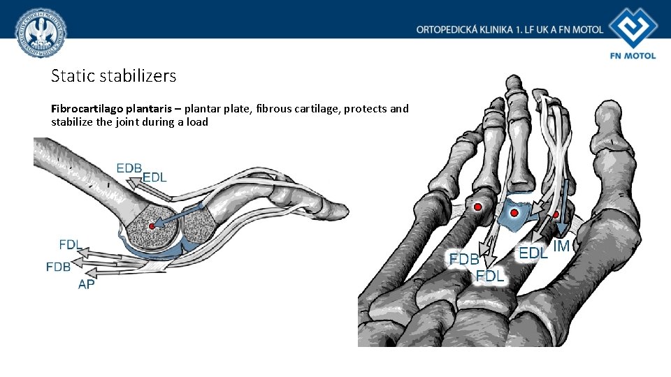 Static stabilizers Fibrocartilago plantaris – plantar plate, fibrous cartilage, protects and stabilize the joint Static stabilizers Fibrocartilago plantaris – plantar plate, fibrous cartilage, protects and stabilize the joint