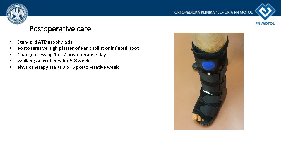 Postoperative care • • • Standard ATB prophylaxis Postoperative high plaster of Paris splint