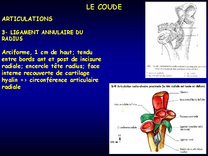 LE COUDE ARTICULATIONS 3 - LIGAMENT ANNULAIRE DU RADIUS Arciforme, 1 cm de haut;