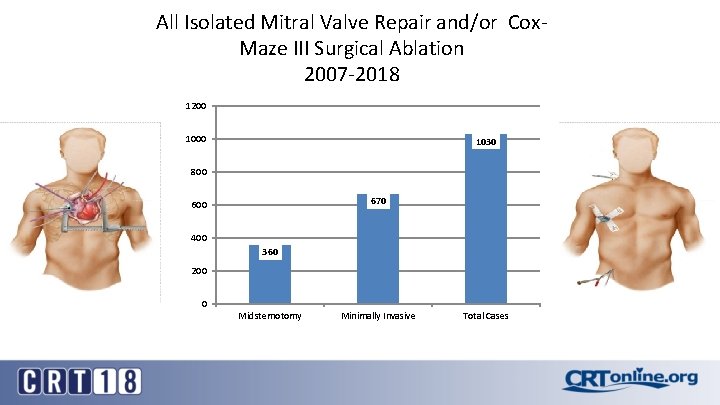 All Isolated Mitral Valve Repair and/or Cox. Maze III Surgical Ablation 2007 -2018 1200