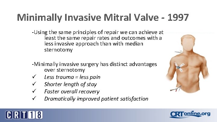 Minimally Invasive Mitral Valve - 1997 -Using the same principles of repair we can