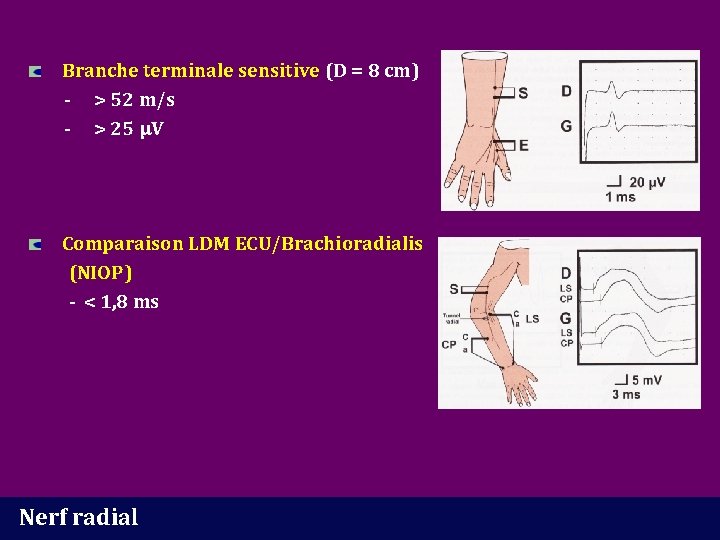 Branche terminale sensitive (D = 8 cm) - > 52 m/s - > 25