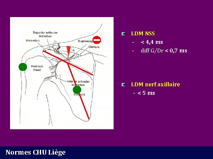 LDM NSS - < 4, 4 ms - diff G/Dr < 0, 7 ms