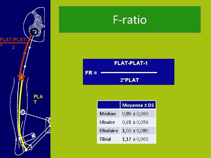 FLAT-PLAT 1 2 F-ratio 1 ms FLAT-PLAT-1 FR = 2*PLAT PLA T Moyenne ±