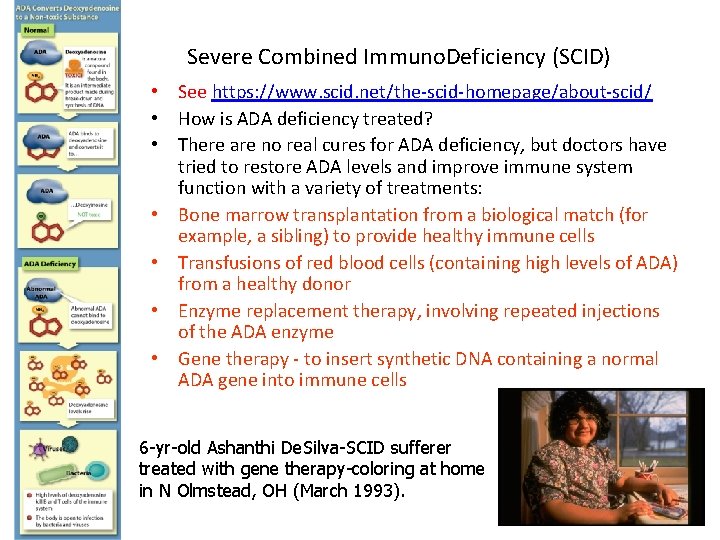 Severe Combined Immuno. Deficiency (SCID) • See https: //www. scid. net/the-scid-homepage/about-scid/ • How is