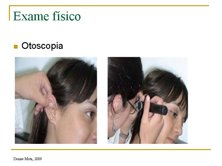 Exame físico n Otoscopia Denise Mota, 2009 