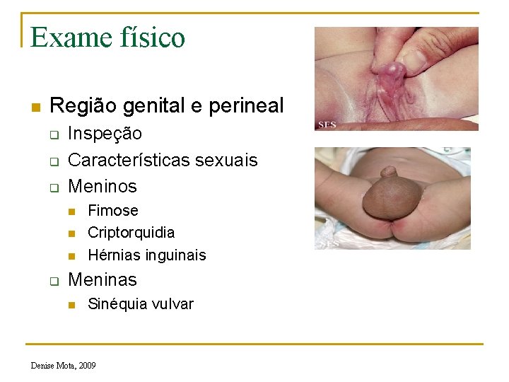 Exame físico n Região genital e perineal q q q Inspeção Características sexuais Meninos