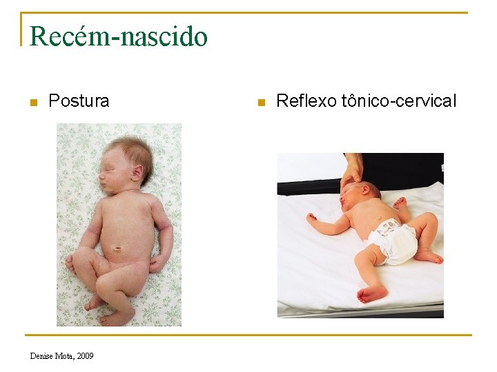 Recém-nascido n Postura Denise Mota, 2009 n Reflexo tônico-cervical 