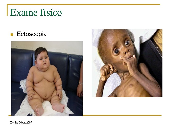 Exame físico n Ectoscopia Denise Mota, 2009 