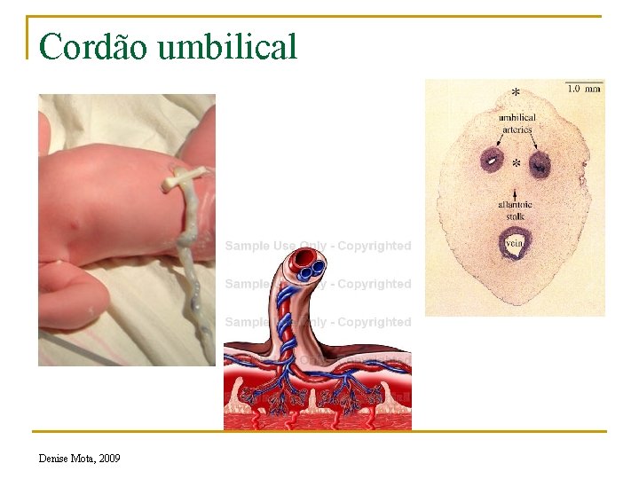 Cordão umbilical Denise Mota, 2009 