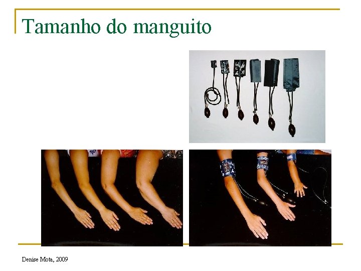 Tamanho do manguito Denise Mota, 2009 