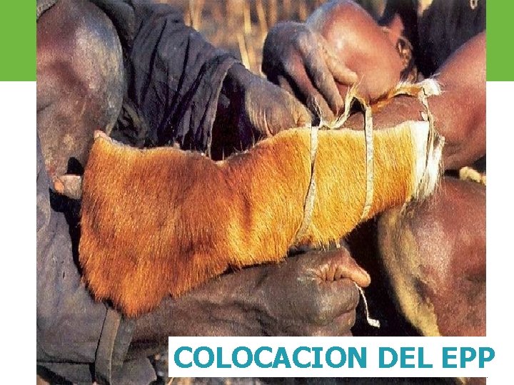 COLOCACION DEL EPP ARP SURA 
