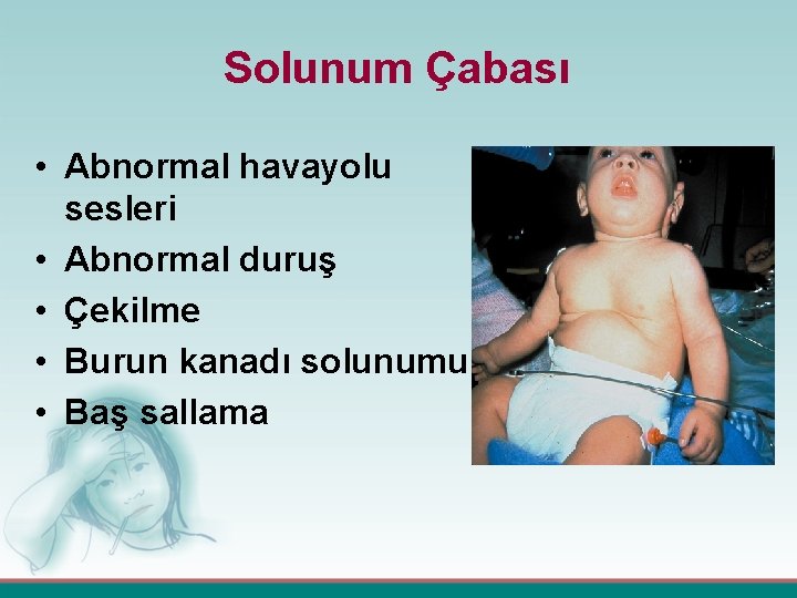 Solunum Çabası • Abnormal havayolu sesleri • Abnormal duruş • Çekilme • Burun kanadı