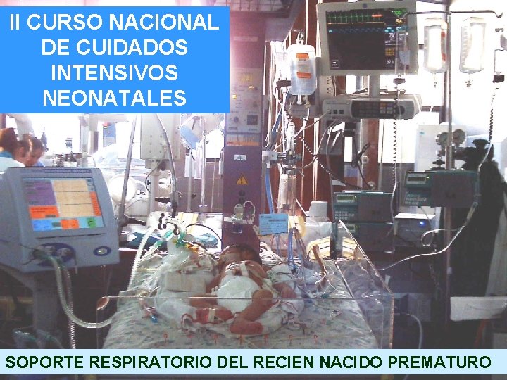 II CURSO NACIONAL DE CUIDADOS INTENSIVOS NEONATALES SOPORTE RESPIRATORIO DEL RECIEN NACIDO PREMATURO 