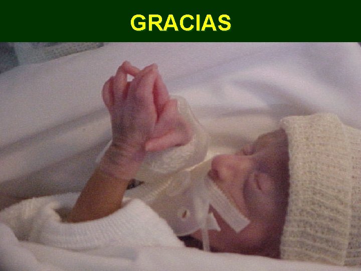 GRACIAS 