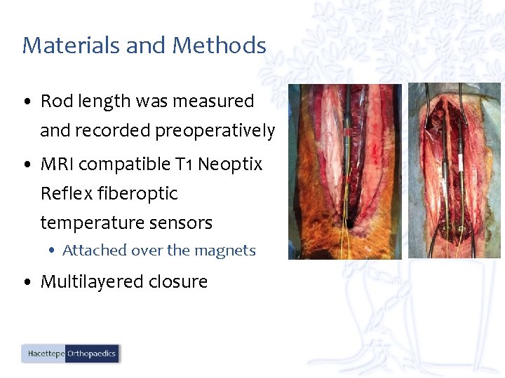 Materials and Methods • Rod length was measured and recorded preoperatively • MRI compatible