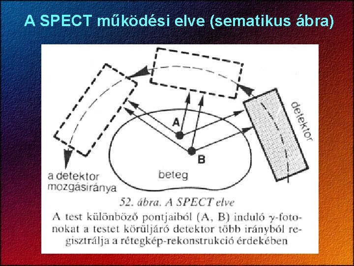 A SPECT működési elve (sematikus ábra) 