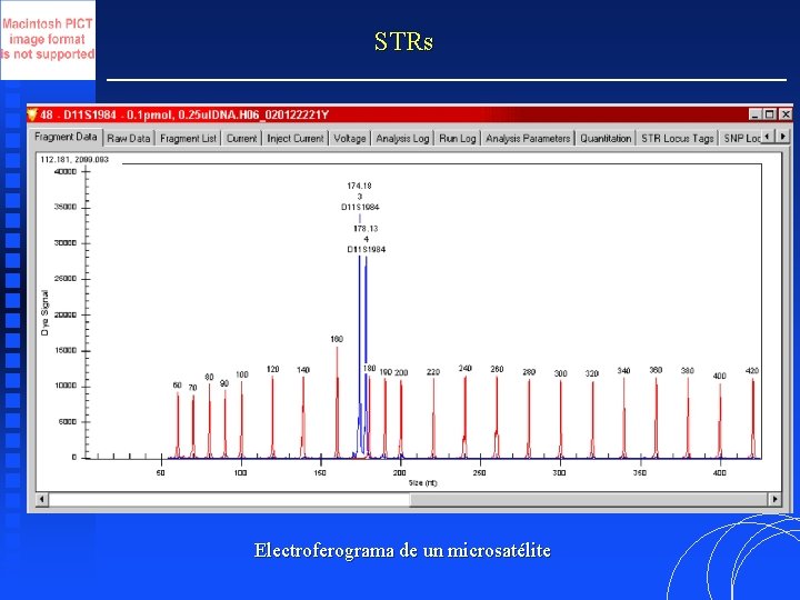 STRs Electroferograma de un microsatélite 