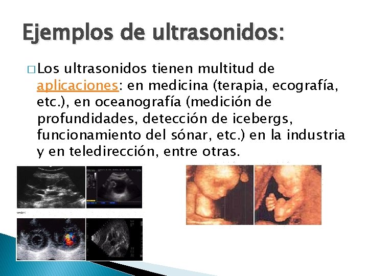 Ejemplos de ultrasonidos: � Los ultrasonidos tienen multitud de aplicaciones: en medicina (terapia, ecografía,