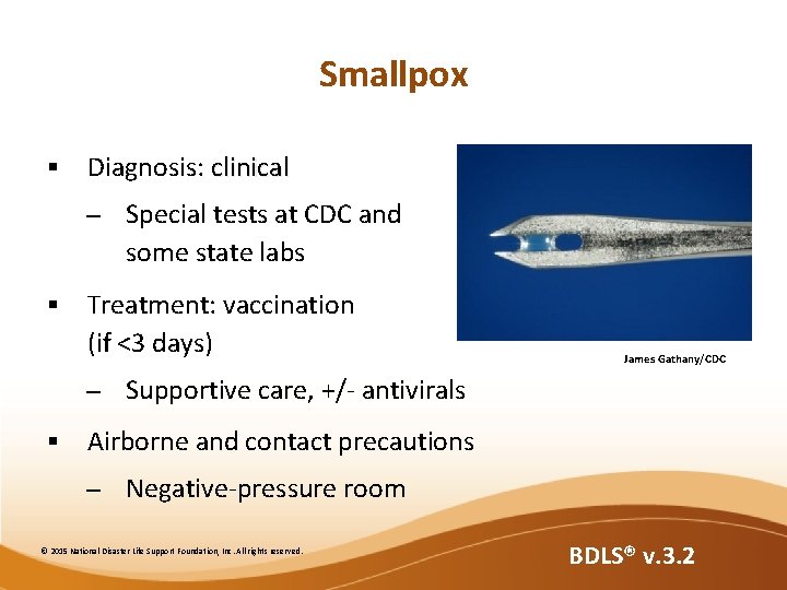 Smallpox § Diagnosis: clinical – § Treatment: vaccination (if <3 days) – § Special Smallpox § Diagnosis: clinical – § Treatment: vaccination (if <3 days) – § Special