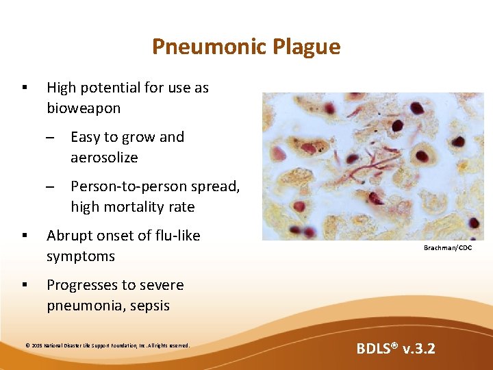 Pneumonic Plague § High potential for use as bioweapon – Easy to grow and Pneumonic Plague § High potential for use as bioweapon – Easy to grow and