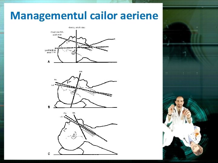 Managementul cailor aeriene 