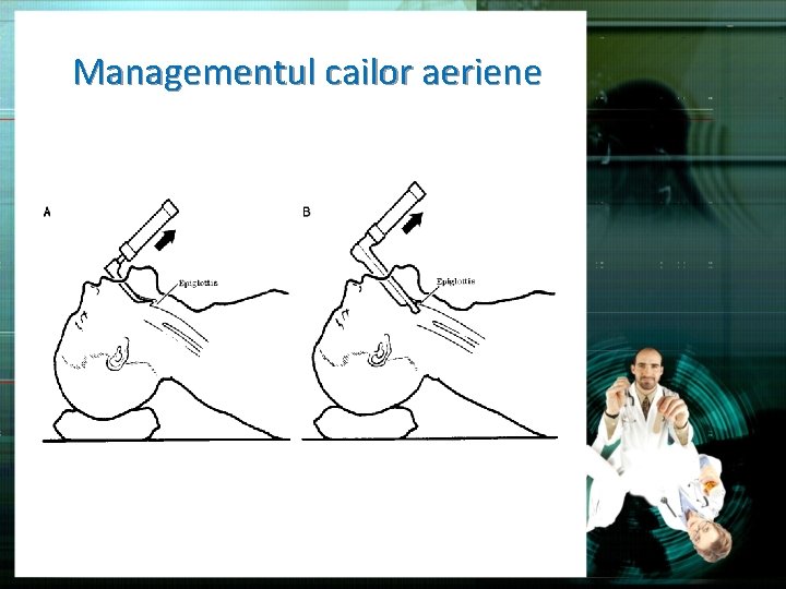 Managementul cailor aeriene 