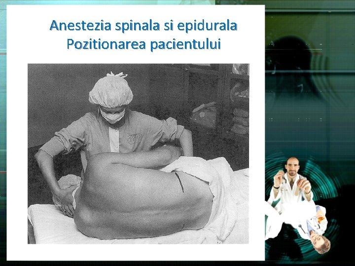 Anestezia spinala si epidurala Pozitionarea pacientului 