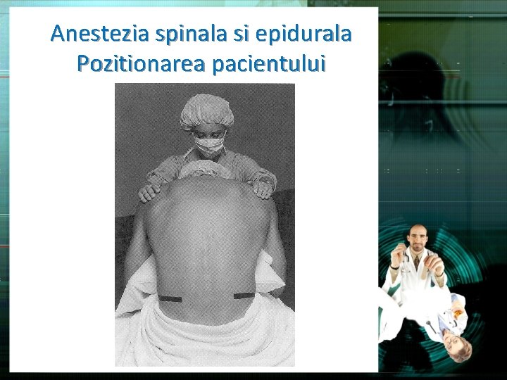 Anestezia spinala si epidurala Pozitionarea pacientului 