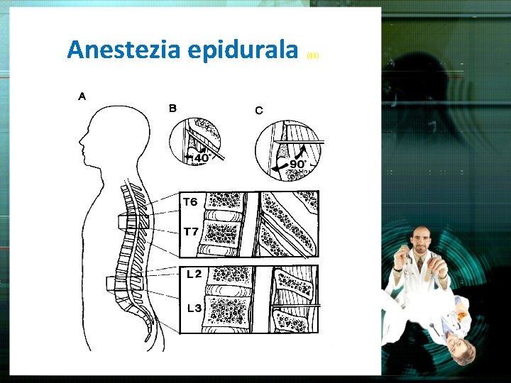 Anestezia epidurala (41) 