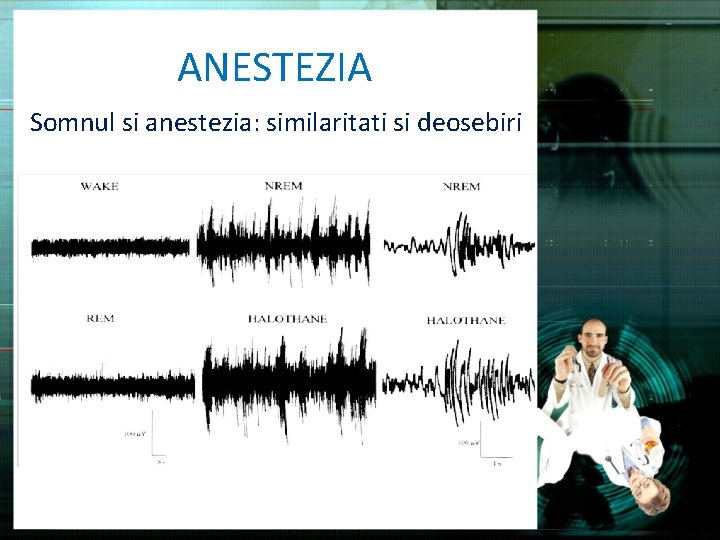 ANESTEZIA Somnul si anestezia: similaritati si deosebiri 