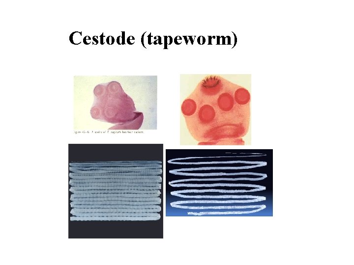  Cestode (tapeworm) 