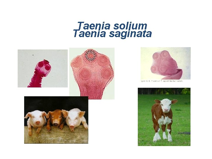 Taenia solium Taenia saginata 