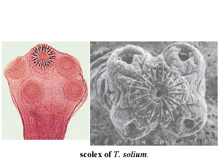 scolex of T. solium. 