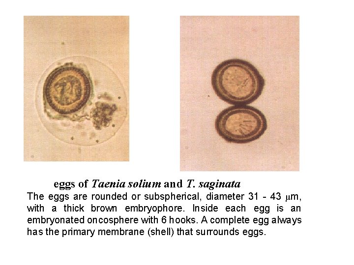  eggs of Taenia solium and T. saginata The eggs are rounded or subspherical,