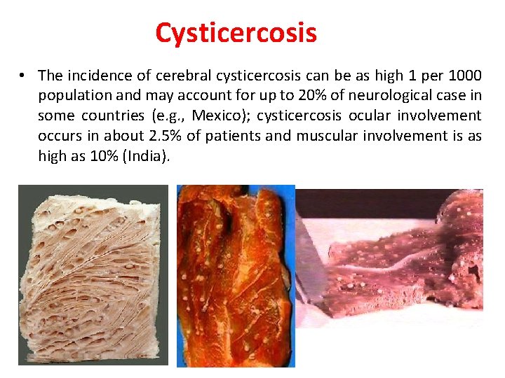 Cysticercosis • The incidence of cerebral cysticercosis can be as high 1 per 1000