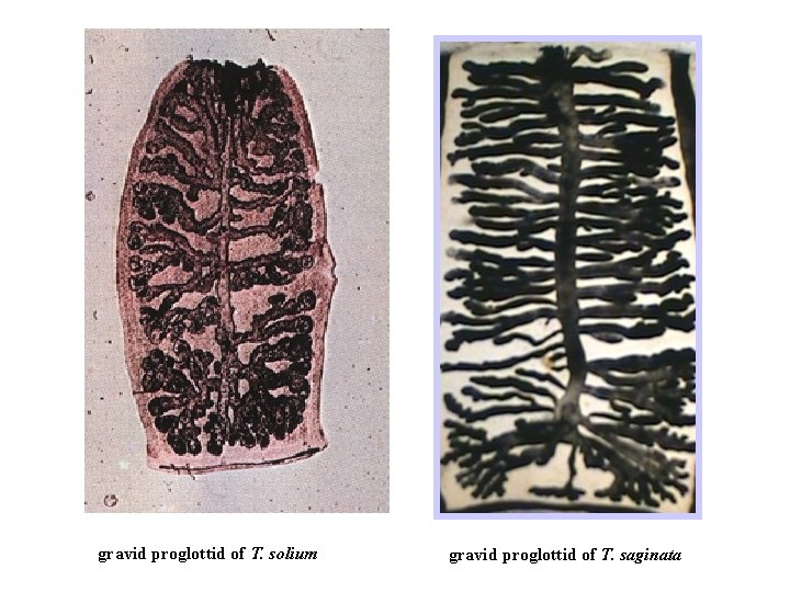 gravid proglottid of T. solium gravid proglottid of T. saginata 