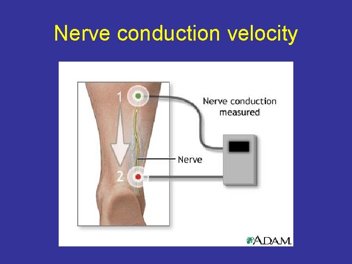 Nerve conduction velocity 