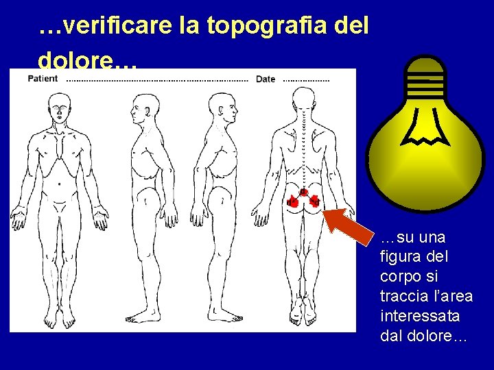 …verificare la topografia del dolore… …su una figura del corpo si traccia l’area interessata