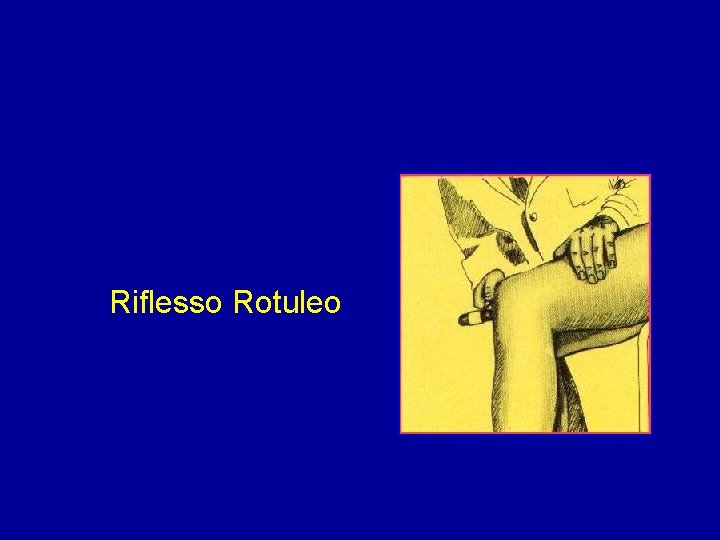 Riflesso Rotuleo 