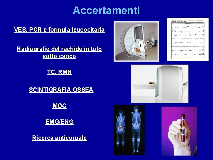 Accertamenti VES, PCR e formula leucocitaria Radiografie del rachide in toto sotto carico TC,