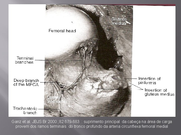 Ganz et al. JBJS Br 2000 ; 82: 679 -683 : suprimento principal da