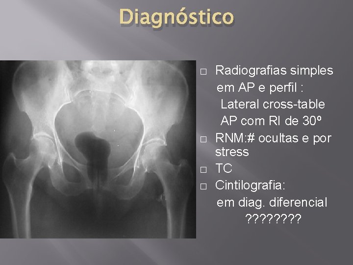 Diagnóstico Radiografias simples em AP e perfil : Lateral cross-table AP com RI de